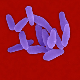 Trẻ em thường mắc căn bệnh này. Tuy nhiên, người lớn cũng có nguy cơ mắc bệnh bạch hầu nếu không có miễn dịch.