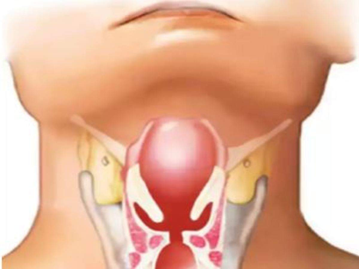 Đến năm 1996, số lượng mắc bệnh bạch hầu ở Nga giảm dần và được khống chế.