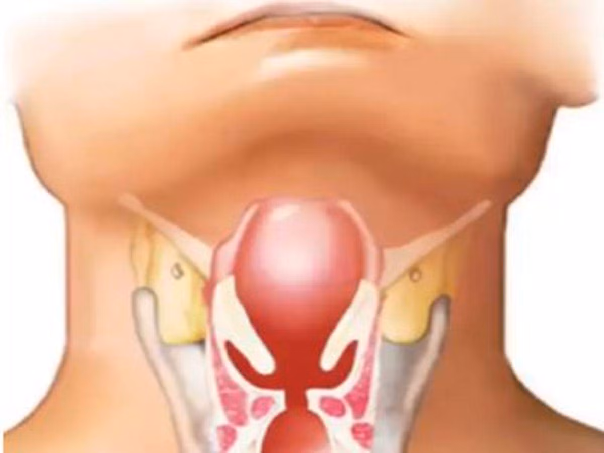 Đến năm 1996, số lượng mắc bệnh bạch hầu ở Nga giảm dần và được khống chế.
