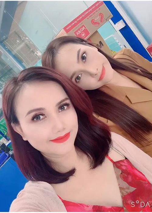 "Cô Xuyến" của "Những ngày không quên" thừa nhận chỉnh sửa gương mặt một chút nhưng chủ yếu là làm lại răng.