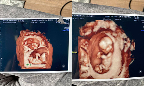 Khac Viet khoe vo DJ mang thai doi, he lo luon gioi tinh thai nhi-Hinh-2