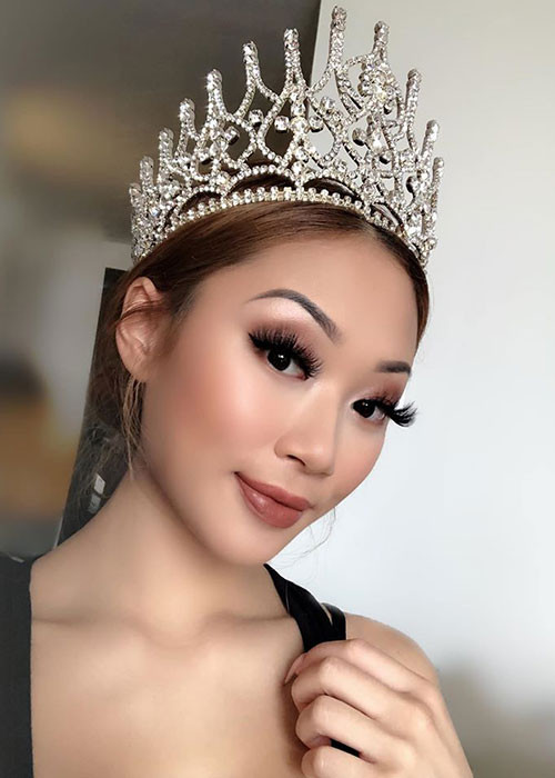 Người đẹp sinh năm 1998 có tiền sử bệnh tim mạch trước khi bị đột quỵ.