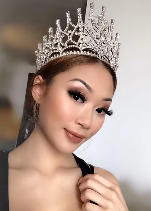 Người đẹp sinh năm 1998 có tiền sử bệnh tim mạch trước khi bị đột quỵ.