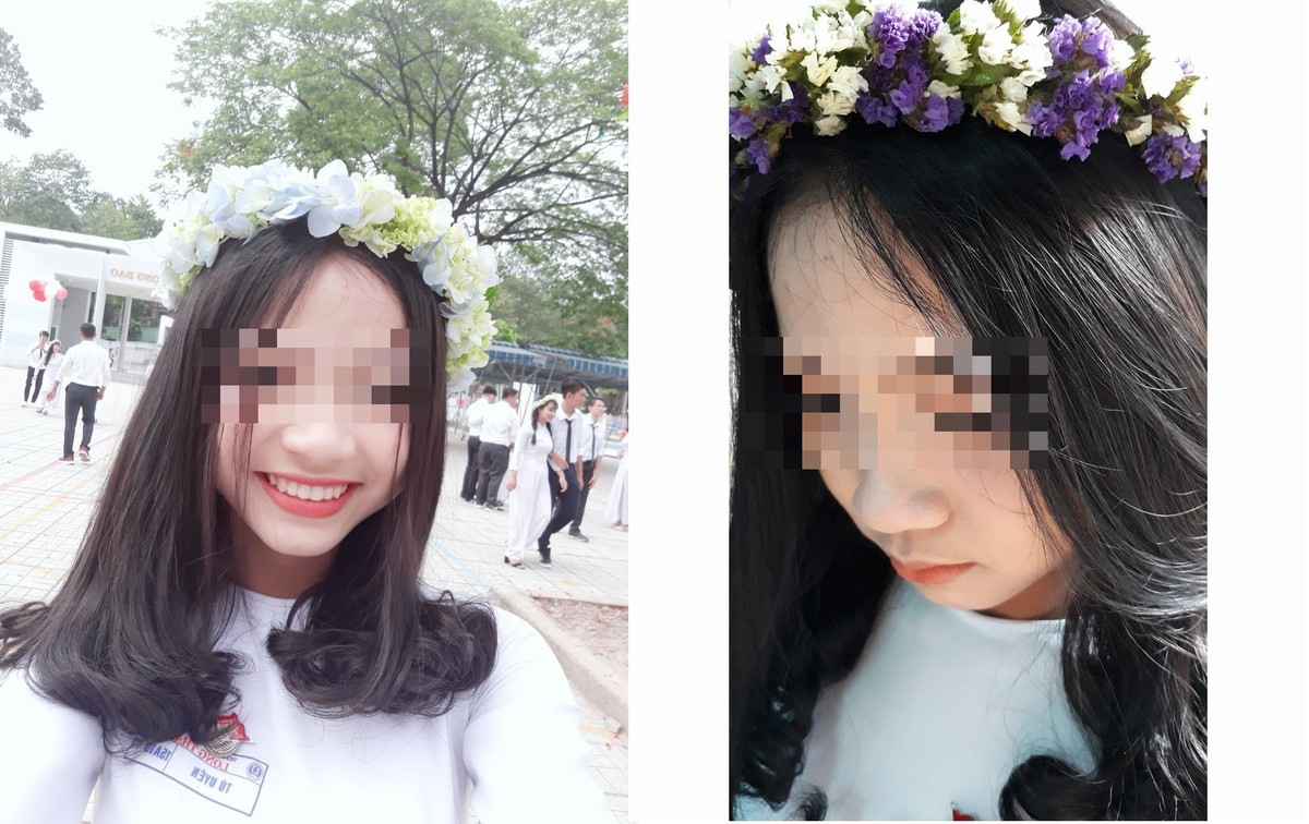 Nạn Uyên đang là sinh viên ĐH Khoa học Xã hội và Nhân văn (ĐH Quốc gia TP HCM).