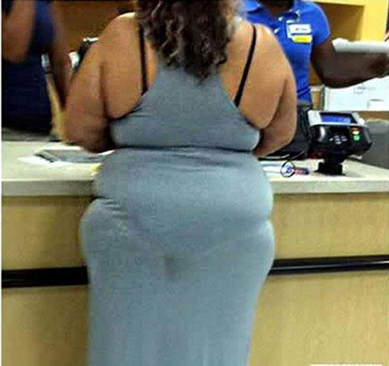 Trường hợp này khiến người phụ nữ như bó giò.