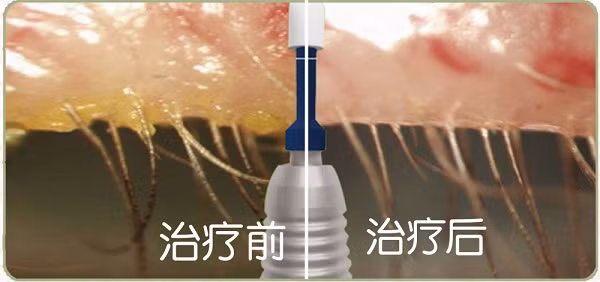 Dau mat, co gai hoang hon phat hien nhung nhuc “vat the la”