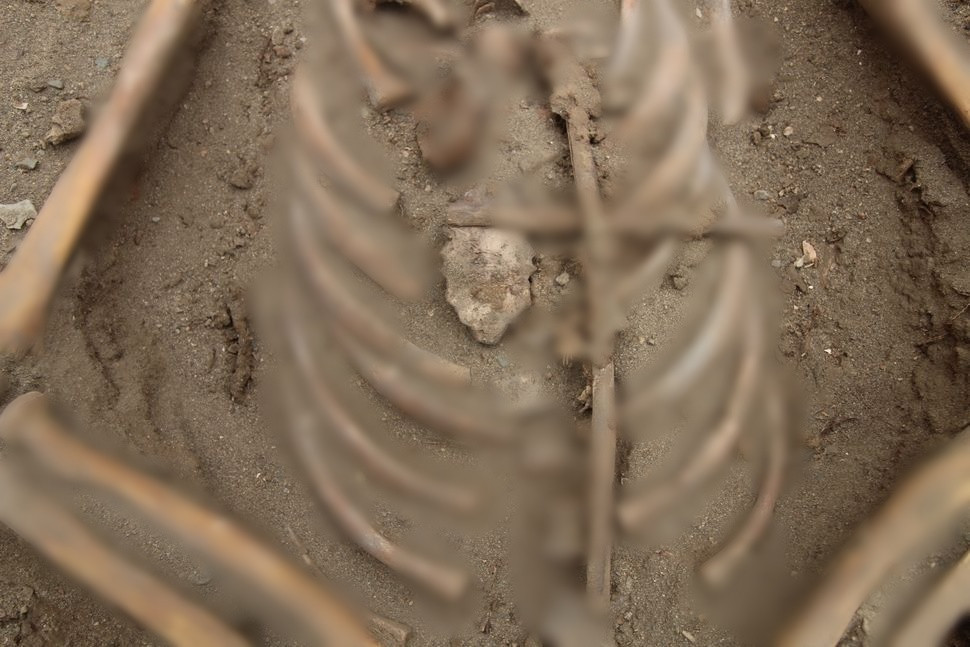 Kết quả nghiên cứu của các chuyên gia chỉ ra hai đứa trẻ người Inca qua đời cách đây khoảng 500 năm. Nguyên nhân tử vong là vì căn bệnh đậu mùa.