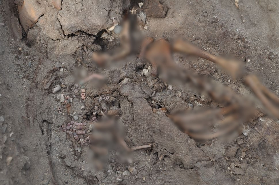 Nhóm nghiên cứu cho hay phát hiện này có thể chứa thông tin quan trọng về việc người Inca mắc các bệnh truyền nhiễm sau khi tiếp xúc với người châu Âu.