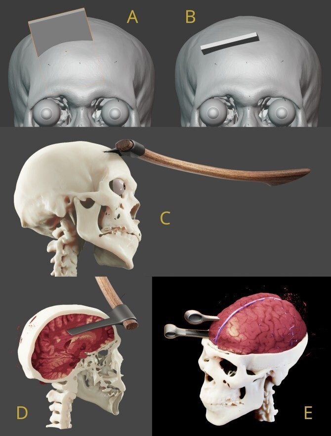Phần tay của xác ướng pharaoh Seqenenre-Tao II bị biến dạng cho thấy hai tay của ông bị trói quặt sau lưng.