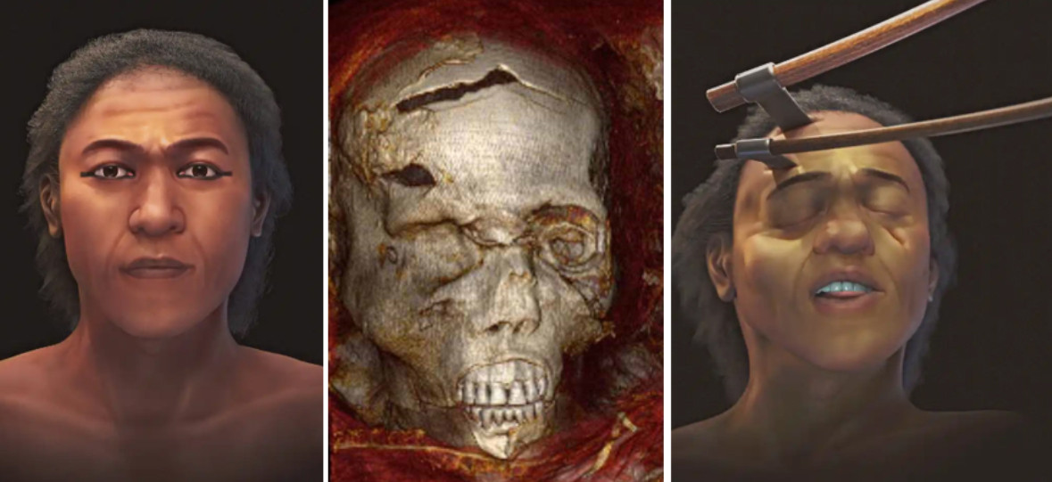 Theo đó, ông hoàng Ai Cập không thể ngăn chặn được cú tấn công mãnh liệt vào đầu do kẻ địch gây ra. Cú đánh mạnh này được cho là nguyên nhân chí mạng dẫn tới cái chết của nhà vua Seqenenre-Tao II.