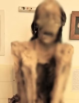 Nhóm chuyên gia đến từ bệnh viện Bogenhausen, Munich, Đức đã tiến hành kiểm tra, phân tích xác ướp hơn 1.000 tuổi của một người đàn ông được trưng bày ở Bảo tàng giải phẫu, Marburg.