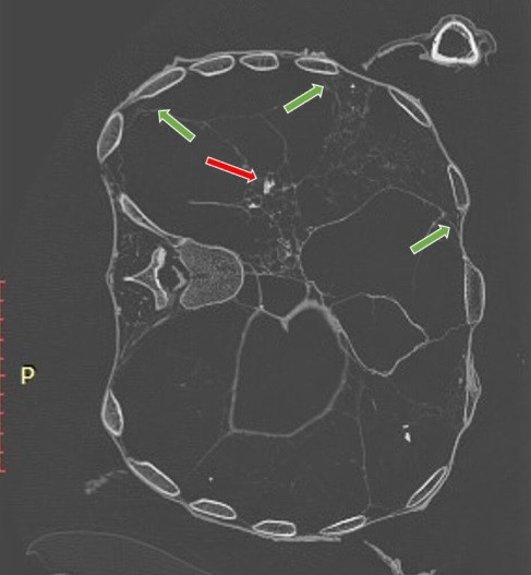 Từ các đặc điểm xương và kết quả phân tích xác ướp bằng phương pháp chụp cắt lớp vi tính 3D (3D-CT), nhóm nghiên cứu ước tính người đàn ông qua đời khi khoảng 20 - 25 tuổi, cao khoảng 1,72m.