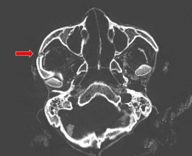 Sau khi qua đời, người đàn ông được chôn ở tư thế ngồi xổm. Một số chiếc răng của người này còn nguyên vẹn cho thấy độ mài mòn thường gặp ở những người dùng ngô như nguồn thức ăn chính trong suốt thời gian dài.