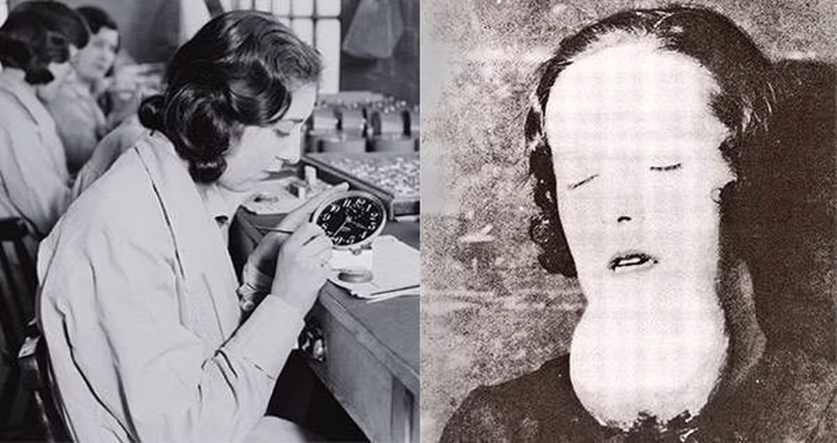 Theo đó, hơn 4.000 nữ công nhân làm việc trong các nhà máy sản xuất đồng hồ đã từ từ nhiễm độc radium mà không hay biết. Các nhà khoa học cho hay khi tiếp xúc với radium trong thời gian dài, người ta sẽ có nguy cơ hoại tử xương, ung thư xương..., thậm chí tử vong.