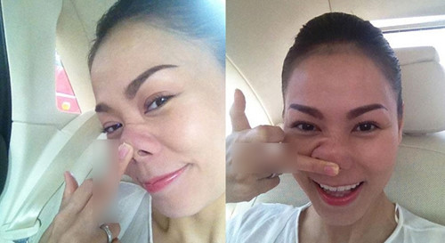 Thu Minh biến hóa với chiếc mũi bác bỏ nghi án dao kéo