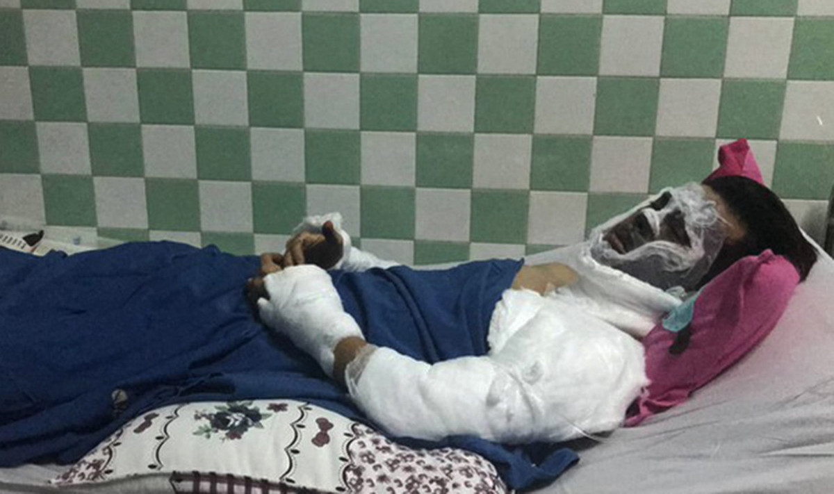 Vu Viet kieu bi tat axit: Bo Cong an vao cuoc quyet bat thu pham