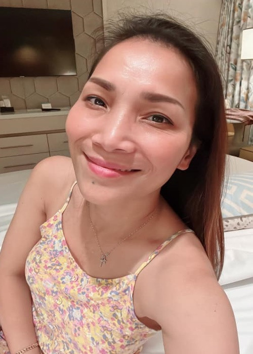 3 năm sau vụ bỏng, giọng ca "Mắt nai cha cha cha" hoàn toàn lấy lại được vẻ ngoài như trước.