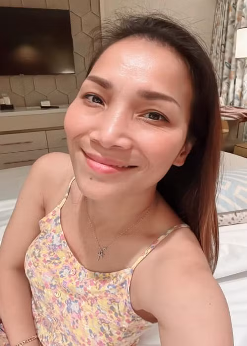 3 năm sau vụ bỏng, giọng ca "Mắt nai cha cha cha" hoàn toàn lấy lại được vẻ ngoài như trước.