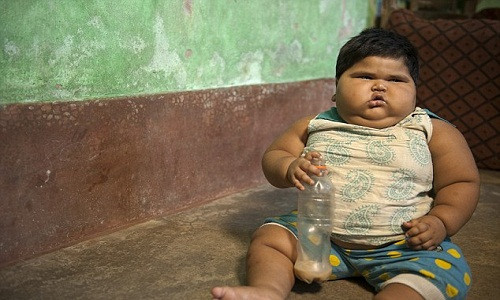 Mới 18 tháng tuổi, nhưng Aliya có trọng lượng tương đương đứa trẻ 8 tuổi.