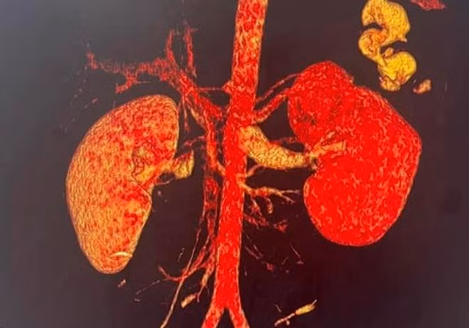 Quang Binh: Cuu song nam sinh bi dam thung than “thap tu nhat sinh“