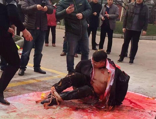 Tại Khúc Giang mới đây, chú rể tội nghiệp này đã bị bạn bè xé rách quần áo, trói hai chân, hai tay bằng băng dính sau đó bị đổ giấm, nước tương, mực đỏ, bột mỳ lên người. Khi chưa thấy đủ thử thách, những người bạn còn lấy cả bình cứu hỏa để xịt khí bọt vào người chú rể, khiến chú rể kinh hãi.