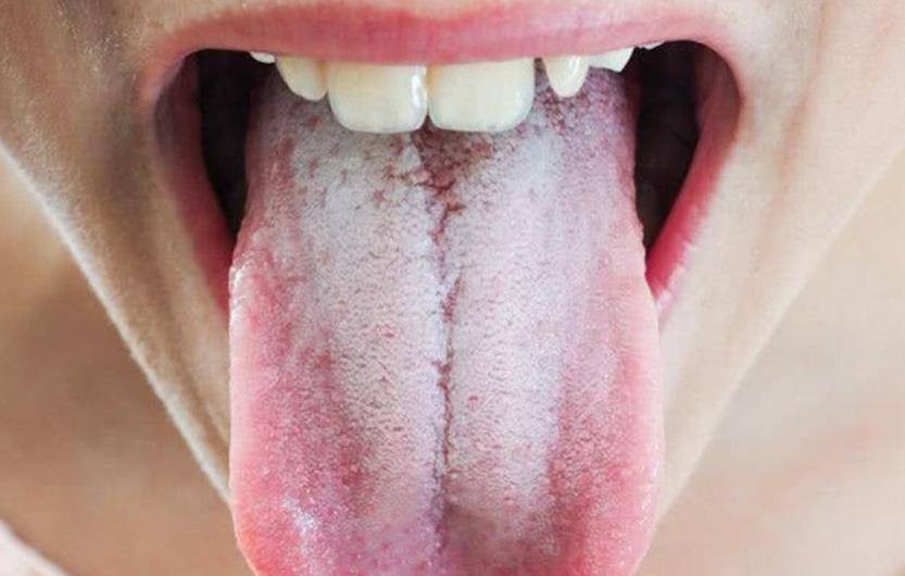 Nguoi huyet ap cao thay 3 hien tuong nay, den vien kham ngay-Hinh-2