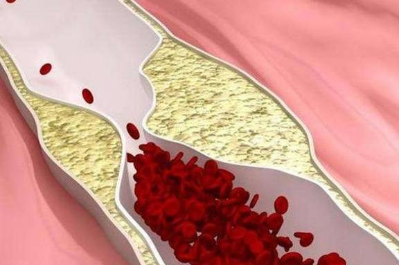 Sang ngu day co 3 dau hieu nay, xet nghiem mau ngay