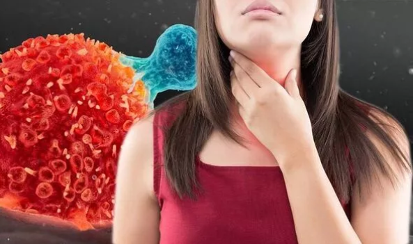 Dau hieu ung thu thuc quan cuc de nham voi benh khac