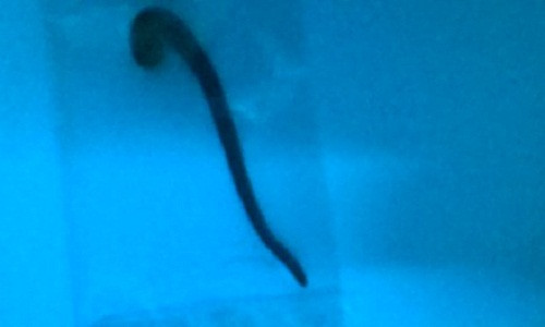 Con vắt đã được bắt ra ngoài