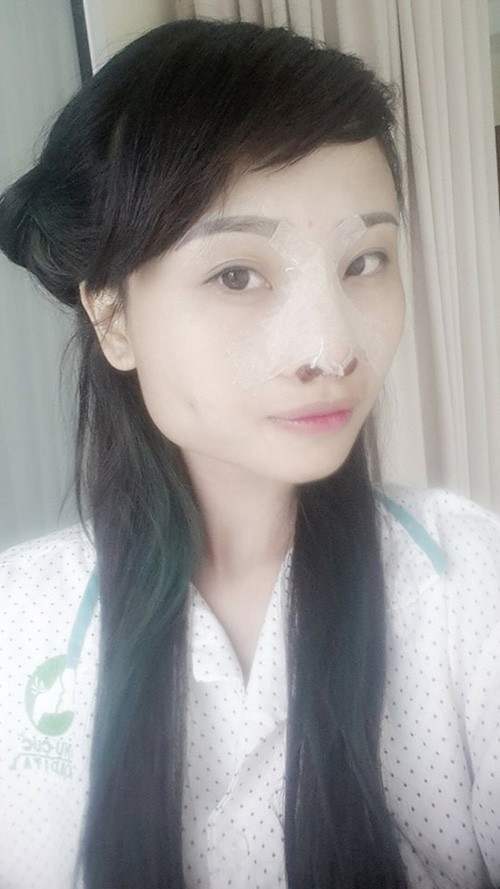 Cô nàng làm phẫu thuật cách đây 2 hôm, bao gồm tạo má lúm và sửa mũi, chịu không ít đau đớn. Hiện tại Loan đang trong thời gian hồi phục, chưa được cắt chỉ, tháo băng trên khuôn mặt... Nói về những hình ảnh sau khi làm phẫu thuật thẩm mỹ, Chippy Polla cho biết đây có lẽ là những hình ảnh xấu nhất của cô.