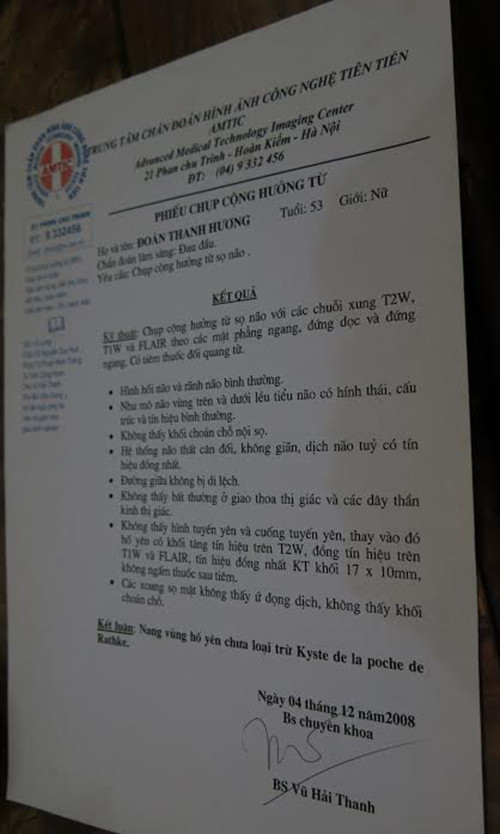 Nguoi phu nu Viet chua khoi khoi u tuyen yen bang tap luyen-Hinh-2