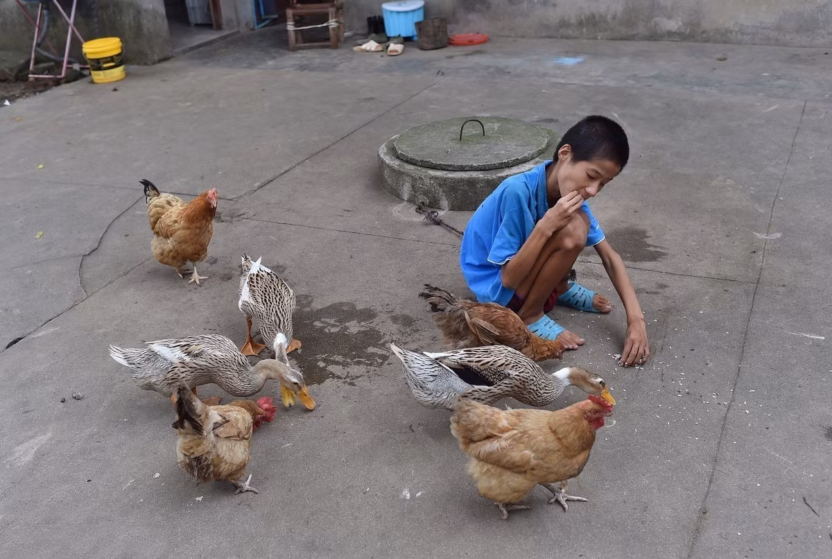 Mang bệnh từ nhỏ, tinh thần của Kiệt Kiệt đã có vấn đề, quanh năm ở trong phòng, ngoại trừ việc có thể tự ăn, tự đi vệ sinh, mọi nhu cầu khác đều cần người chăm sóc, giúp đỡ. (Nguồn Sina)