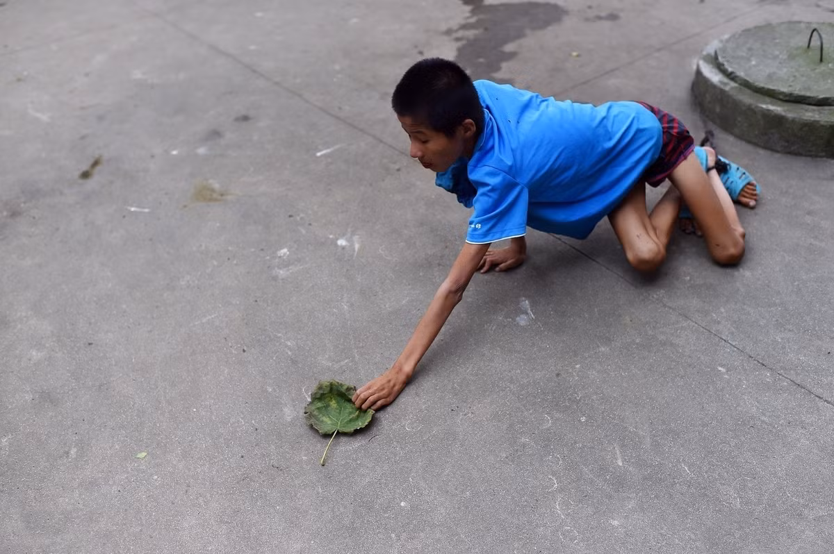 Sau khi thông tin được đăng tải, nhiều người mong rằng hoàn cảnh của Kiệt Kiệt sẽ được các tổ chức từ thiện để ý và giúp đỡ. (Nguồn Sina)