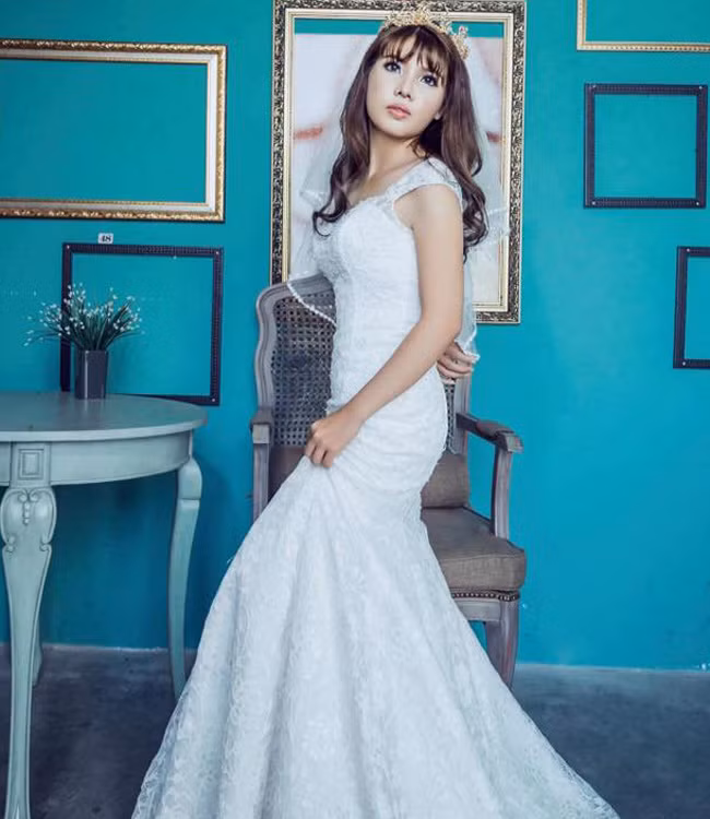 Thời gian đầu sau thẩm mỹ, gương mặt của Phượng còn sưng phồng nhưng sau 3 tháng phẫu thuật, các đường nét đã tự nhiên và hài hòa hơn.