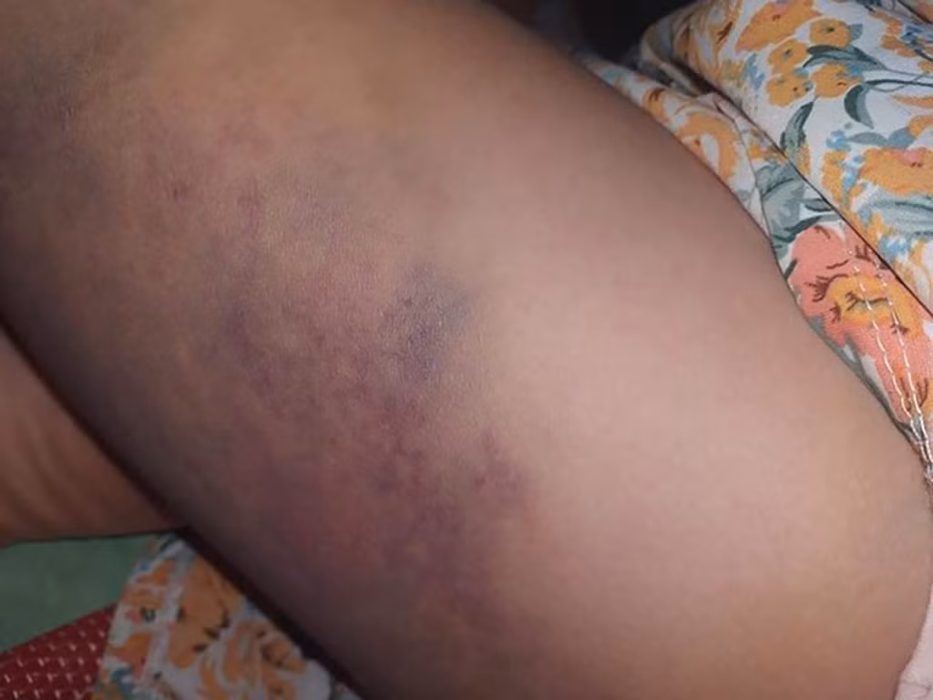 Co giao danh hoc sinh lop 3 tim dui o Dak Lak bi tam dinh chi