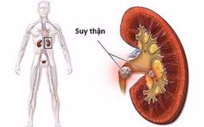 Nhung thoi quen xau “am tham” gay suy than