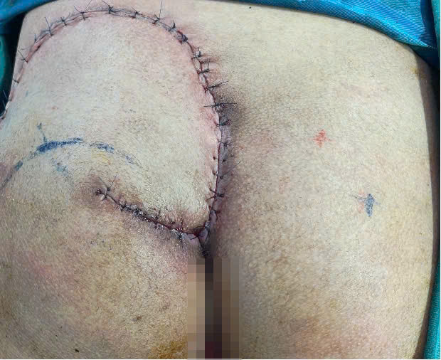 Loet ti de, moi nguy tham lang voi nguoi nam bat dong dai ngay-Hinh-2