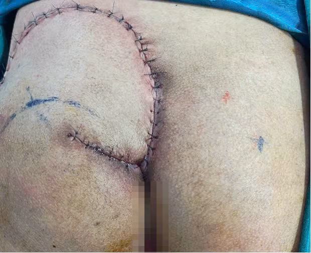 Loet ti de, moi nguy tham lang voi nguoi nam bat dong dai ngay-Hinh-2