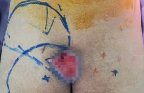 Loet ti de, moi nguy tham lang voi nguoi nam bat dong dai ngay