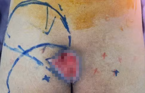 Loet ti de, moi nguy tham lang voi nguoi nam bat dong dai ngay