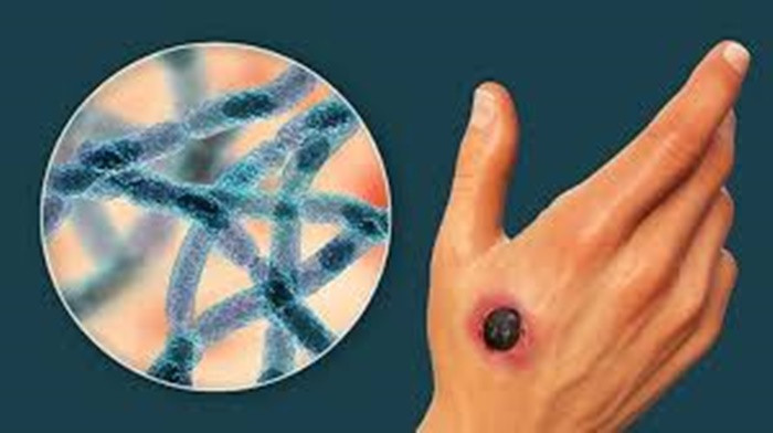 Thai Lan ghi nhan ca tu vong dau tien do benh than