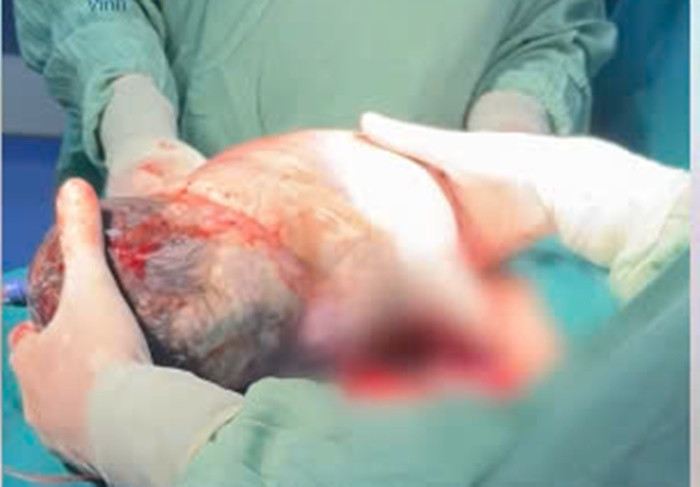 Ca sinh hiem gap, em be chao doi van nam nguyen trong tui oi