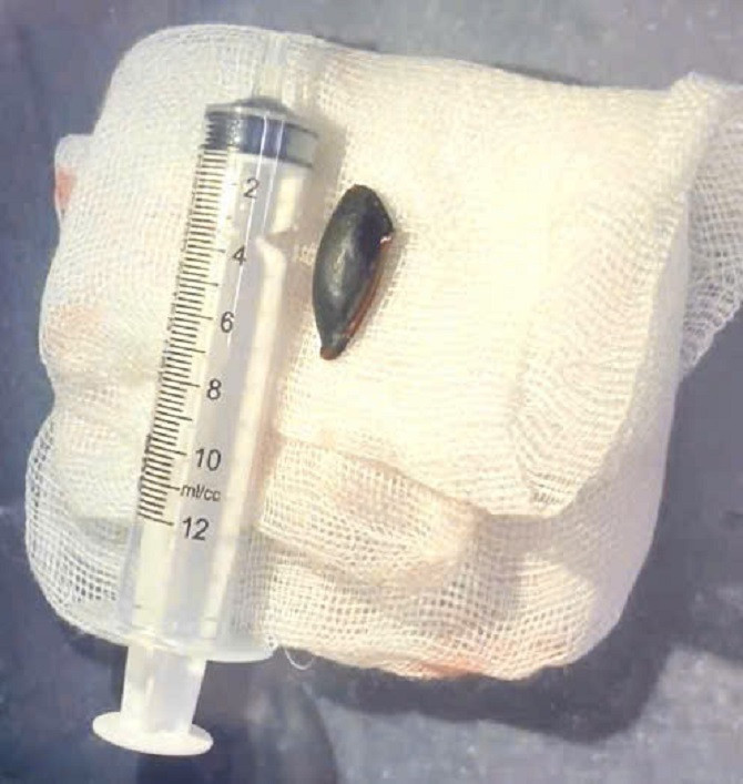 Gap thanh cong hat hong xiem ra khoi phe quan cu ong 85 tuoi