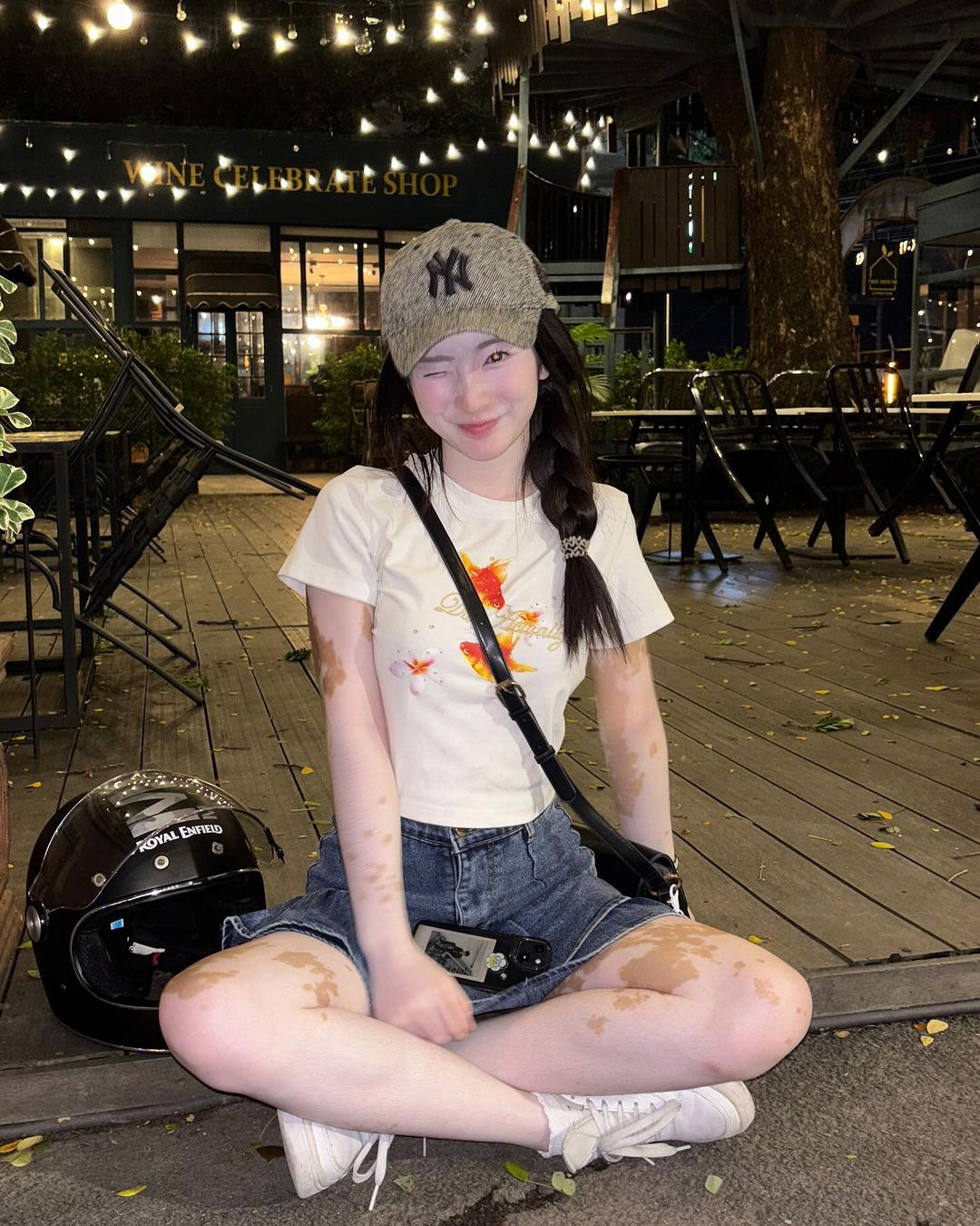 Theo đó, trên làn da trắng sáng của Chralisa ở phần cánh tay, phần đùi là những đốm nâu hiện lên thành các mảng rời rạc, tựa như các vết bớt trông vô cùng nổi bật.