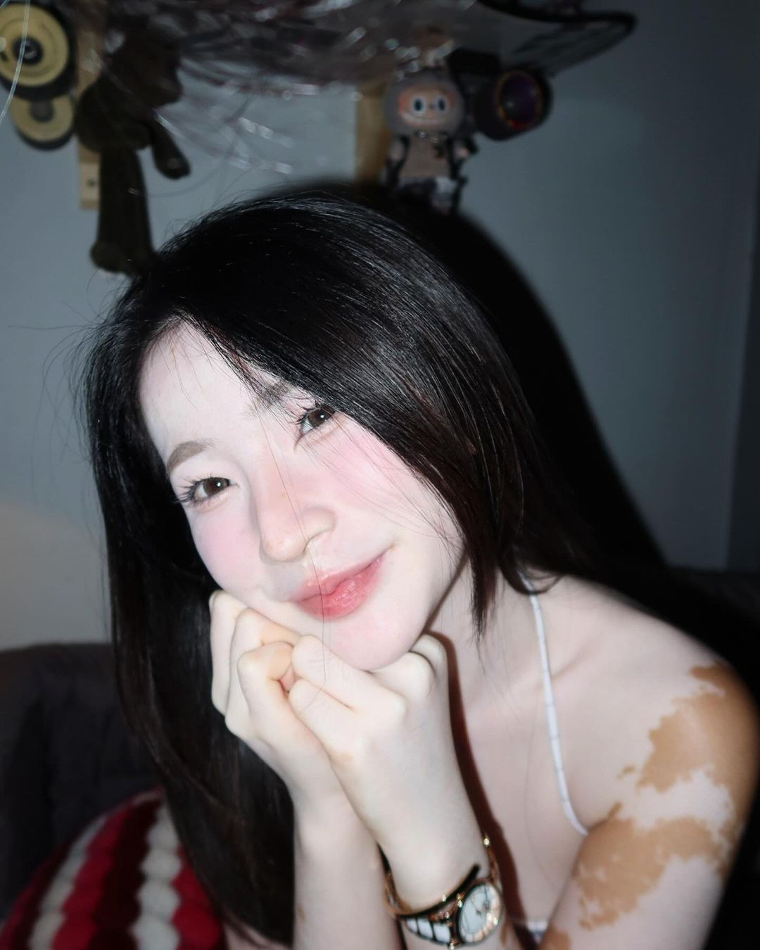 Tuy vậy, những đốm nâu hoàn toàn không lấn át được vẻ đẹp của hot girl xứ Chùa Vàng.