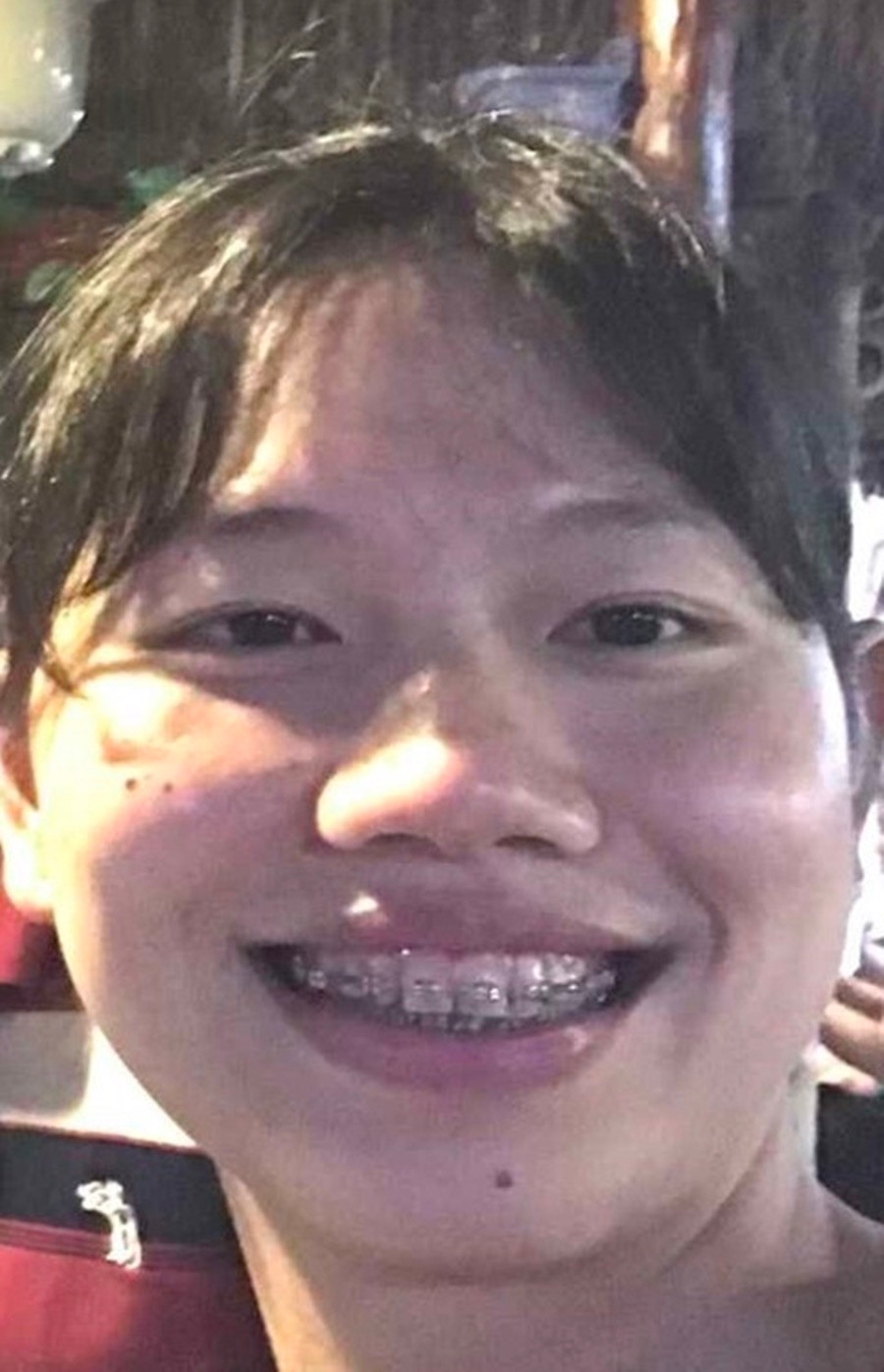 Ánh viên sở hữu nước da ngắm, khuyết điểm là hàm răng không được đều.