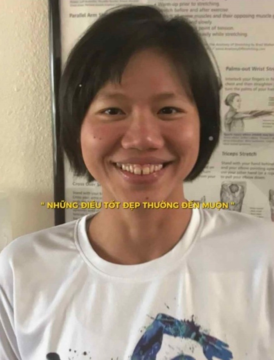 Nguyễn Thị Ánh Viên sinh năm 1996 ở Cần Thơ có biệt danh "Tiểu tiên cá". Cô nàng gây ấn tượng với loạt thành tích giành về cho cá nhân, cũng như cho thể thao nước nhà. Tuy nhiên trước đây ngoại hình của cô nàng không quá nổi bật.