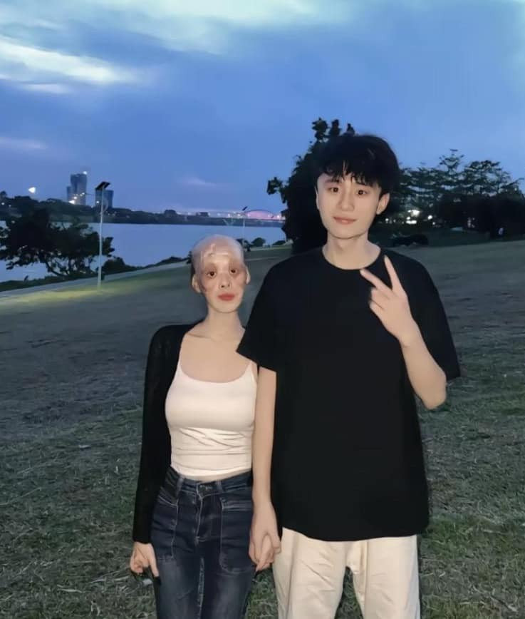 Ngoài ra, nhiều tài khoản còn đăng tải hình ảnh được cho là cô gái trước khi sự việc đau lòng xảy ra. Trong ảnh, cô là nữ sinh gây ấn tượng với vẻ ngoài xinh xắn, đôi mắt to và dịu dàng nên nhiều người càng xót xa hơn khi so với diện mạo hiện tại.