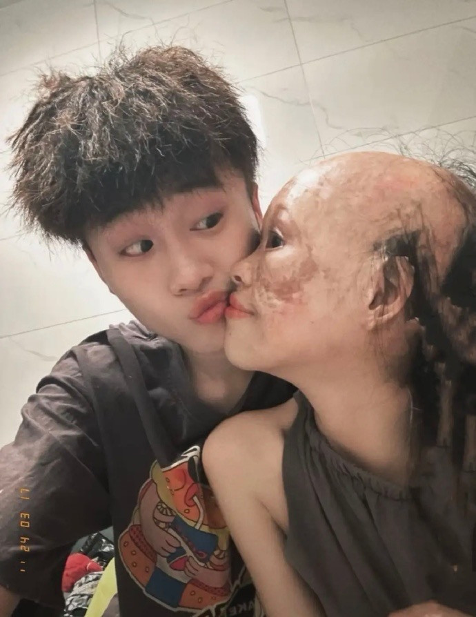 Bản thân Tiểu Lý - nữ chính của câu chuyện cũng không ngại đối mặt với ngoại hình đặc biệt của mình và phản ứng sợ sệt từ mọi người.