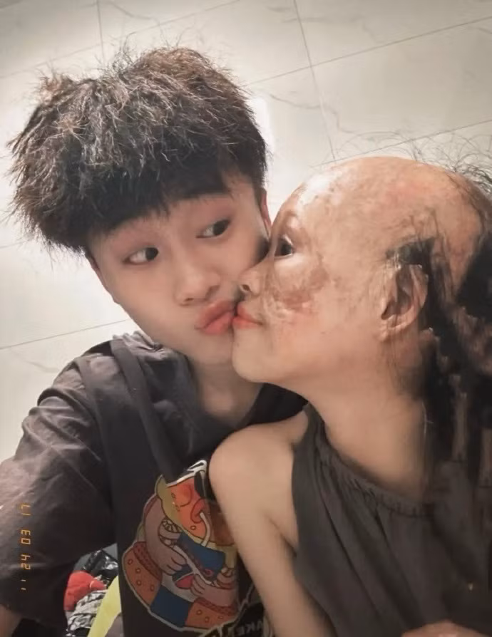 Bản thân Tiểu Lý - nữ chính của câu chuyện cũng không ngại đối mặt với ngoại hình đặc biệt của mình và phản ứng sợ sệt từ mọi người.